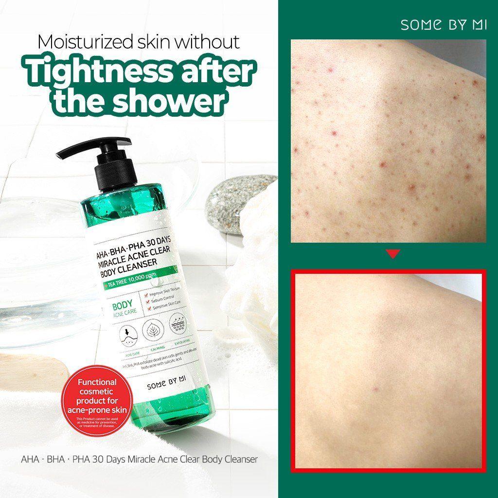 Some By Mi Miracle Acne Body Cleanser 30 Days