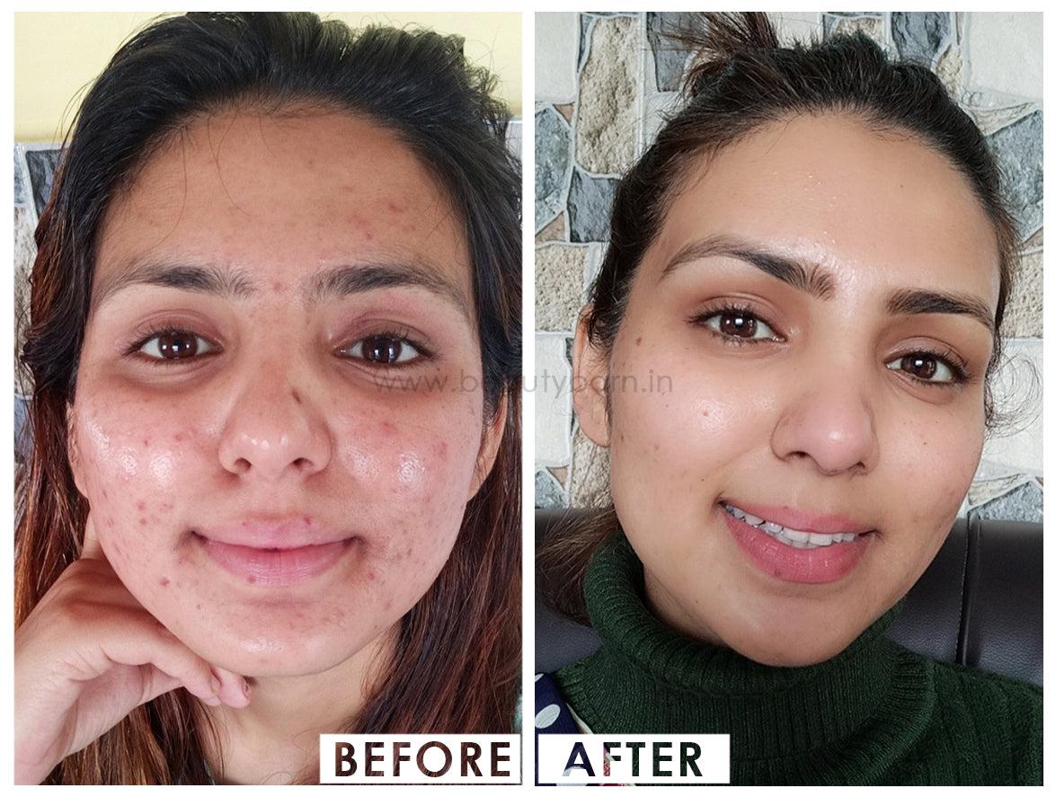 Some By Mi AHA, BHA, PHA 30 Days Miracle Cream Crème aux AHA, BHA, PHA 60g