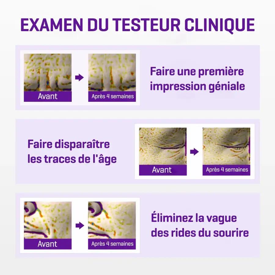 SOMEBYMI RETINOL INTENSE CREME YEUX TRIPLE ACTION 30 ML