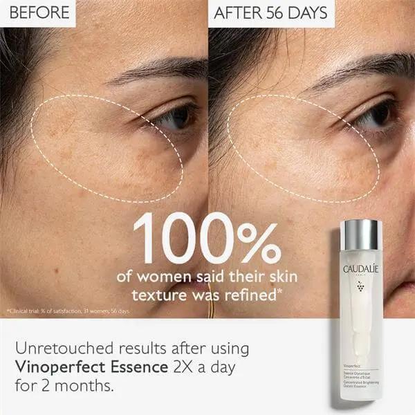 Caudalie VINOPERFECT Essence Glycolique Concentré d' Eclat 100ml Soin Anti-tâches, Eclat Toutes Peaux