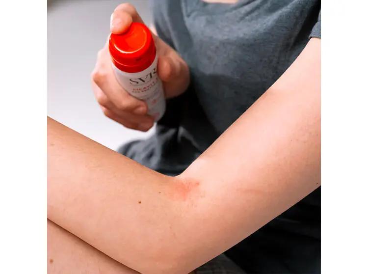 SVR Cicavit+ Spray SOS grattage 40ml