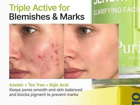 Purito SEOUL Azelaic Acid 10 Kojic Tea Tree Serum visage 30ml