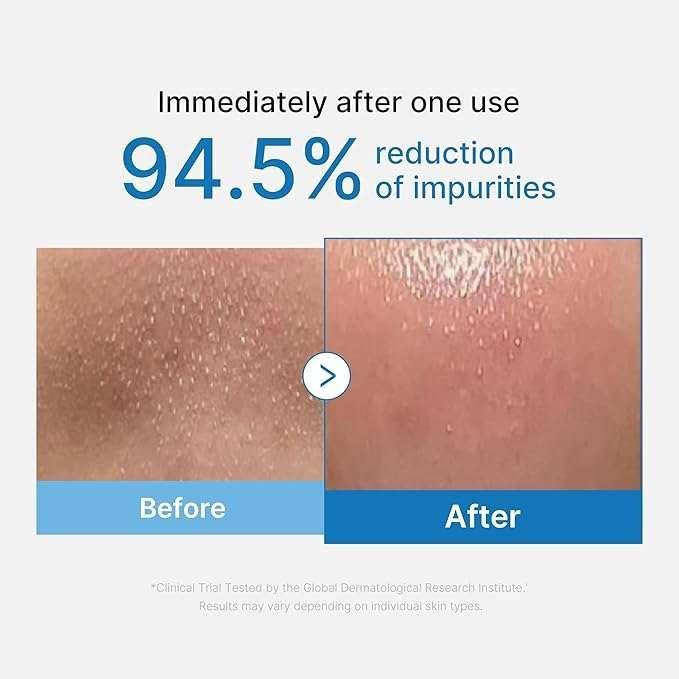 Medicube Zero Pore Blackhead Deep Cleansing Oil Huile Nettoyante 205ml