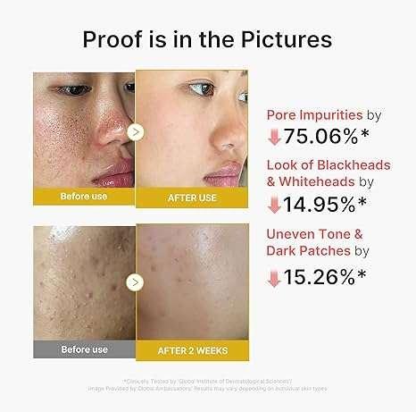 Medicube Kojic Acid Turmeric Peel Shot Sérum Exfoliant 80ml