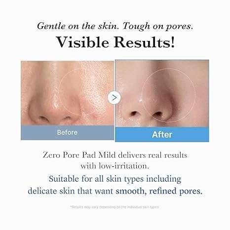 Medicube Zero Pore Pad Mild 70 Pads Disques exfoliants 155g
