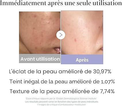 Medicube AGE-R Booster Pro Mini Plus Pink Mini appareil multifonction édition rose
