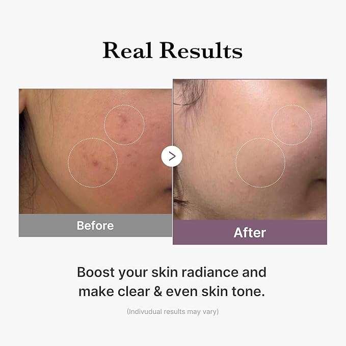 Medicube AGE-R Glutathione Glow Toner Lotion tonique 140ml