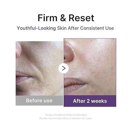 Medicube Retinol NMN Boosting Serum Sérum Visage 30ml