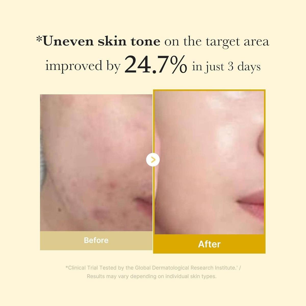 Medicube Kojic Acid Turmeric Night Wrapping Mask Masque de nuit 75 ml