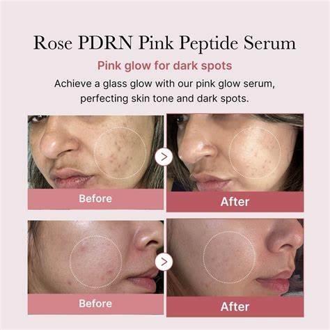 Medicube PDRN Pink Peptide Serum Sérum visage 30ml