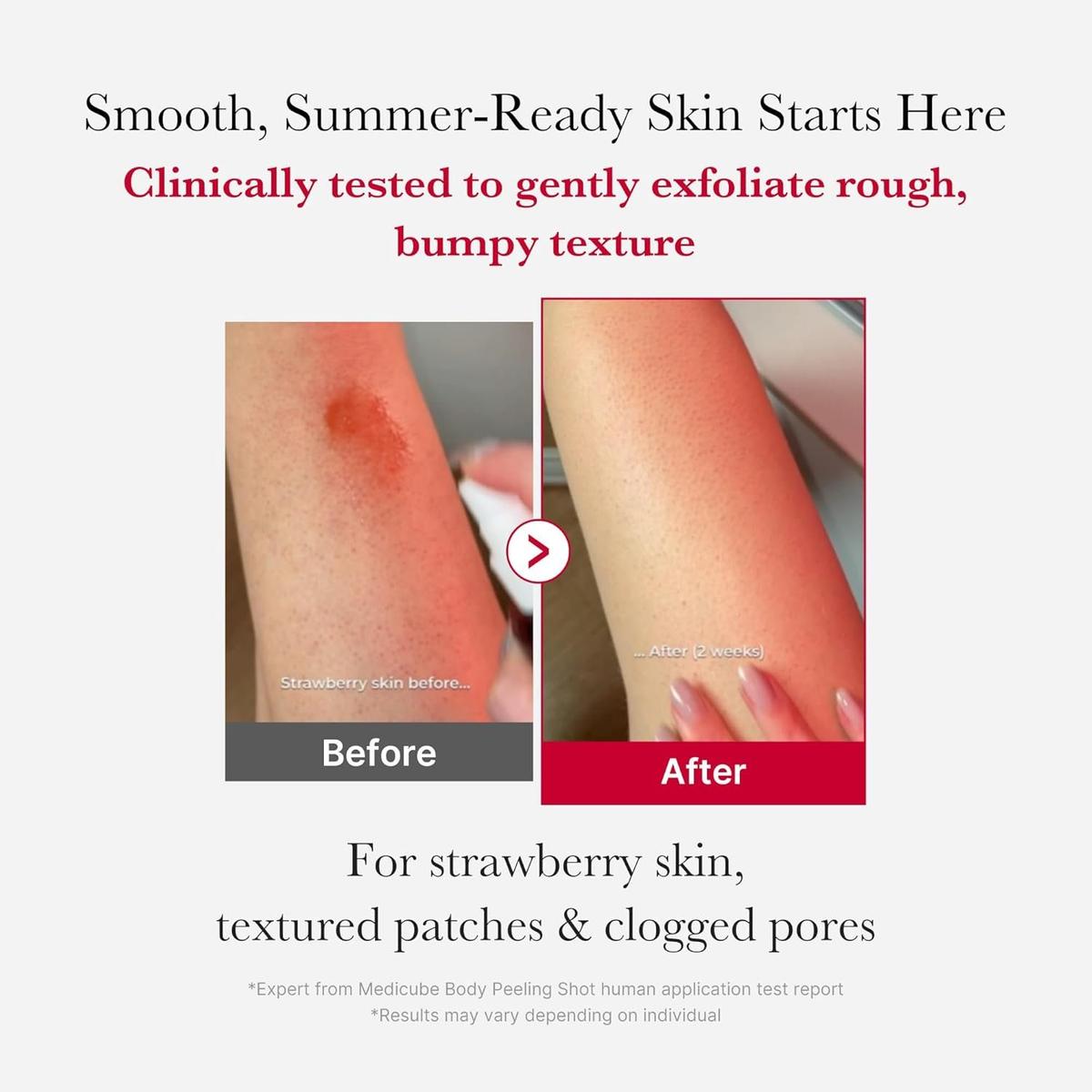 Medicube Red Acne Body Peeling Shot -110g
