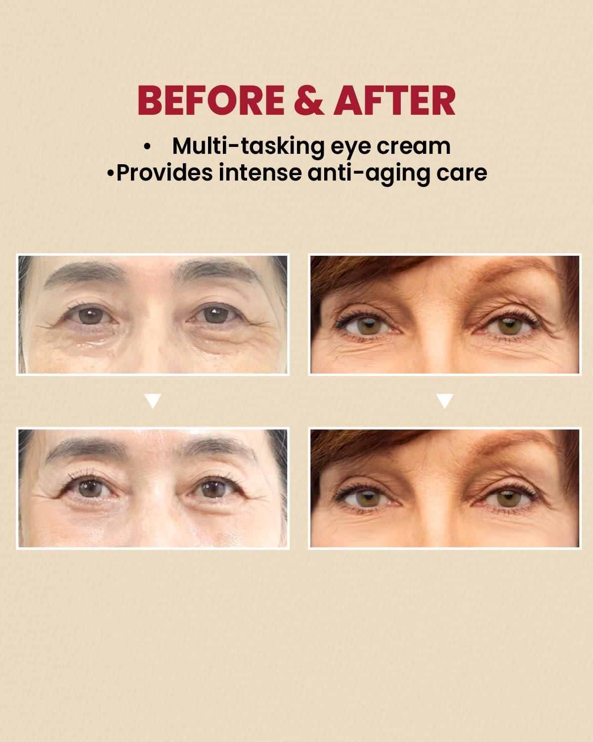 K-SECRET- SEOUL 1988 Eye Cream : Retinal Liposome 4% + Fermented Bean 30ml